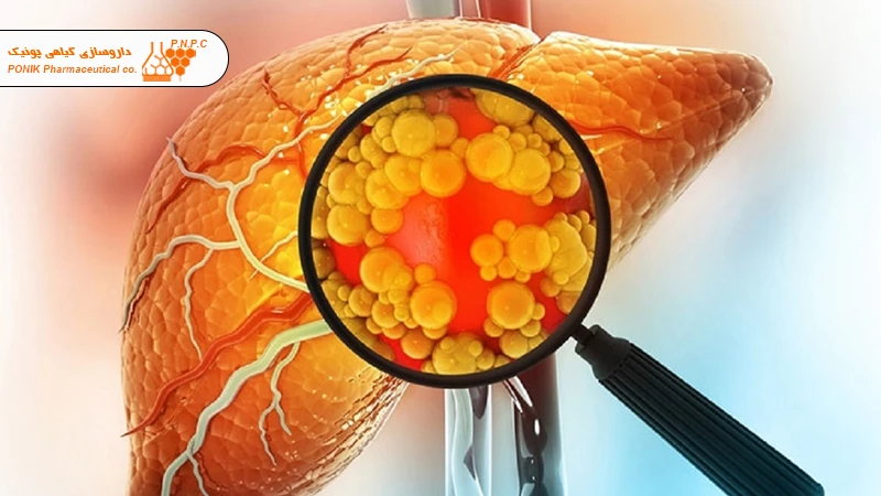 چگونه گرید کبد را پایین بیاوریم؟