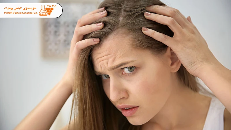 جلوگیری از ریزش موی بانوان